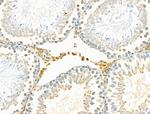 PABPC5 Antibody in Immunohistochemistry (Paraffin) (IHC (P))