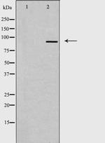 Gemin 3 Polyclonal Antibody