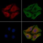 ZDHHC20 Polyclonal Antibody