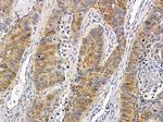 ZDHHC20 Antibody in Immunohistochemistry (Paraffin) (IHC (P))
