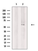 POTEB Polyclonal Antibody