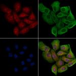 PPP1R14D Polyclonal Antibody