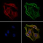 PPP1R3A Polyclonal Antibody