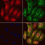 S100A16 Polyclonal Antibody