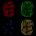 S100A7L2 Polyclonal Antibody