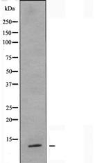 S100Z Polyclonal Antibody