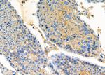 PDXDC1 Antibody in Immunohistochemistry (Paraffin) (IHC (P))