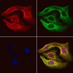 Pyruvate Carboxylase Polyclonal Antibody