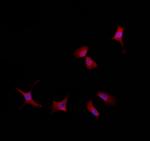 RABEP2 Polyclonal Antibody