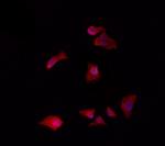 CHML Polyclonal Antibody