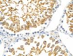 RANBP17 Antibody in Immunohistochemistry (Paraffin) (IHC (P))