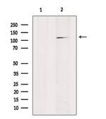 RANBP17 Antibody in Western Blot (WB)