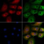 RAB2B Polyclonal Antibody