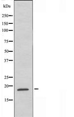 RAP2B Polyclonal Antibody