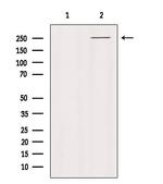 PTPRZ Polyclonal Antibody