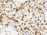 RGS1 Polyclonal Antibody