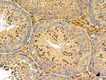 RGS1 Antibody in Immunohistochemistry (Paraffin) (IHC (P))