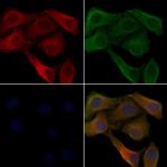 RGS7 Polyclonal Antibody