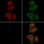 RPTN Polyclonal Antibody