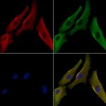 ARHGAP11A Polyclonal Antibody