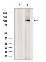 ARHGAP11A Antibody in Western Blot (WB)
