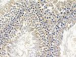 ARHGAP17 Antibody in Immunohistochemistry (Paraffin) (IHC (P))