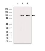 ARHGAP17 Antibody in Western Blot (WB)
