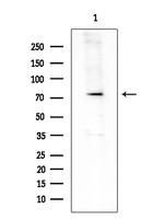ARHGAP18 Antibody in Western Blot (WB)