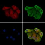 ARHGAP9 Polyclonal Antibody