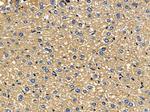 ARHGAP9 Antibody in Immunohistochemistry (Paraffin) (IHC (P))