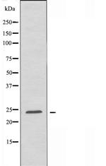 RhoD Antibody in Western Blot (WB)