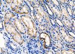 SPINK5 Polyclonal Antibody
