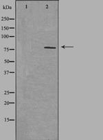 NEK5 Polyclonal Antibody