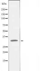 PRKY Polyclonal Antibody