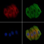 TAOK1 Polyclonal Antibody