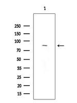 TLK2 Antibody in Western Blot (WB)