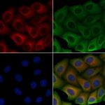 ULK3 Polyclonal Antibody