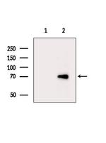 PPP2R5D Polyclonal Antibody
