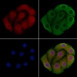 PPP2R1B Polyclonal Antibody