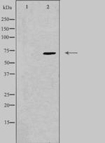 PPP2R3B Antibody in Western Blot (WB)