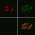 PPP2R3C Polyclonal Antibody