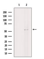 PPP2R3C Antibody in Western Blot (WB)