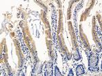 SERPINB12 Polyclonal Antibody