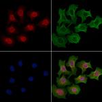 SH3TC1 Polyclonal Antibody