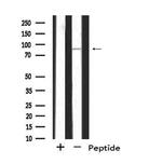 SH3RF3 Antibody in Western Blot (WB)