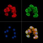 SCN2B Polyclonal Antibody