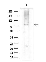 SGLT2 Antibody in Western Blot (WB)