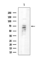 SGLT2 Polyclonal Antibody