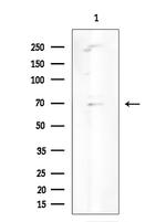 SGLT2 Antibody in Western Blot (WB)