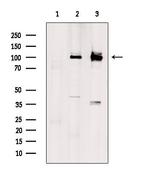 SLC9A6 Polyclonal Antibody